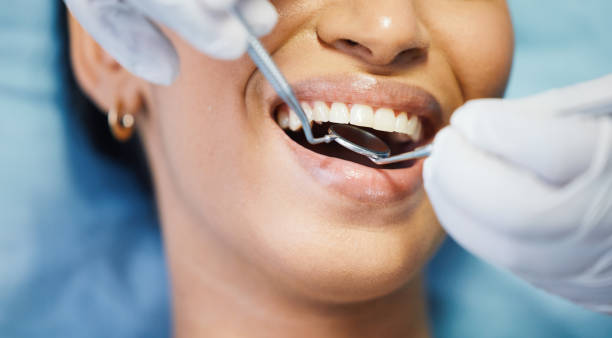 Best Emergency Cosmetic Dentistry (e.g., broken veneers) in Dickinson, TX